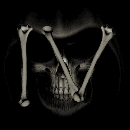 Competitive Broken Bones IV